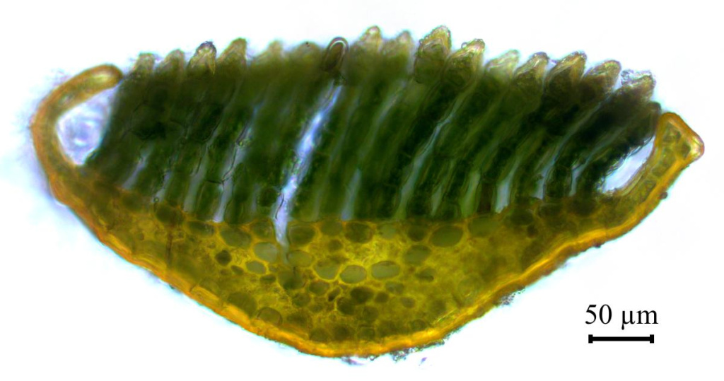 Срез листа Polytrichum alpinum