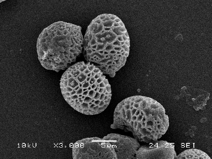 Сетчатые споры Strobilomyces strobilaceus