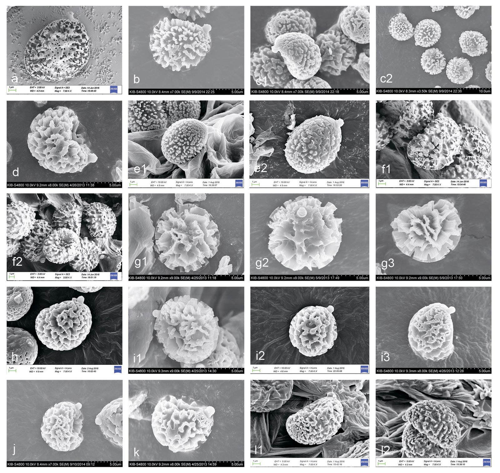 Разные варианты орнаментации спор Strobilomyces