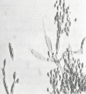 Споры Alternaria