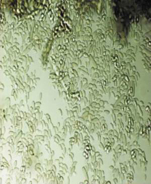 Cladosporium под микроскопом